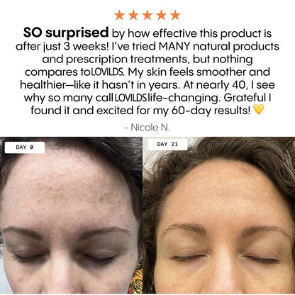 💥Last Day Promotion 80% OFF 🔥LOVILDS® The Complete System for Mature Women’s Skin