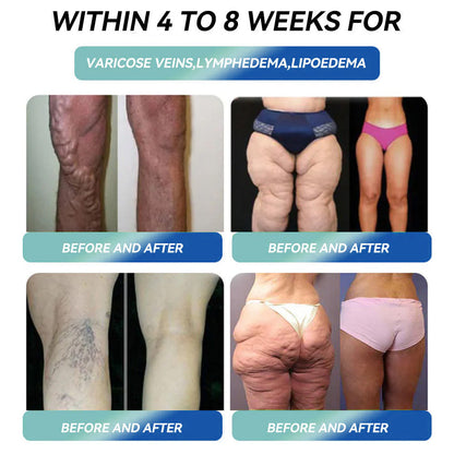👻 Boo-tiful results! Drop 20lbs fast with Grunsify® Patch 🎃 80% OFF this Halloween!
